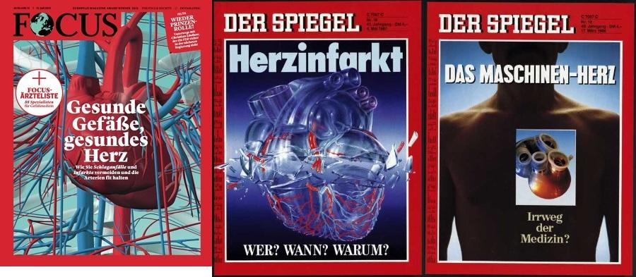 SPIEGEL vs. Focus
